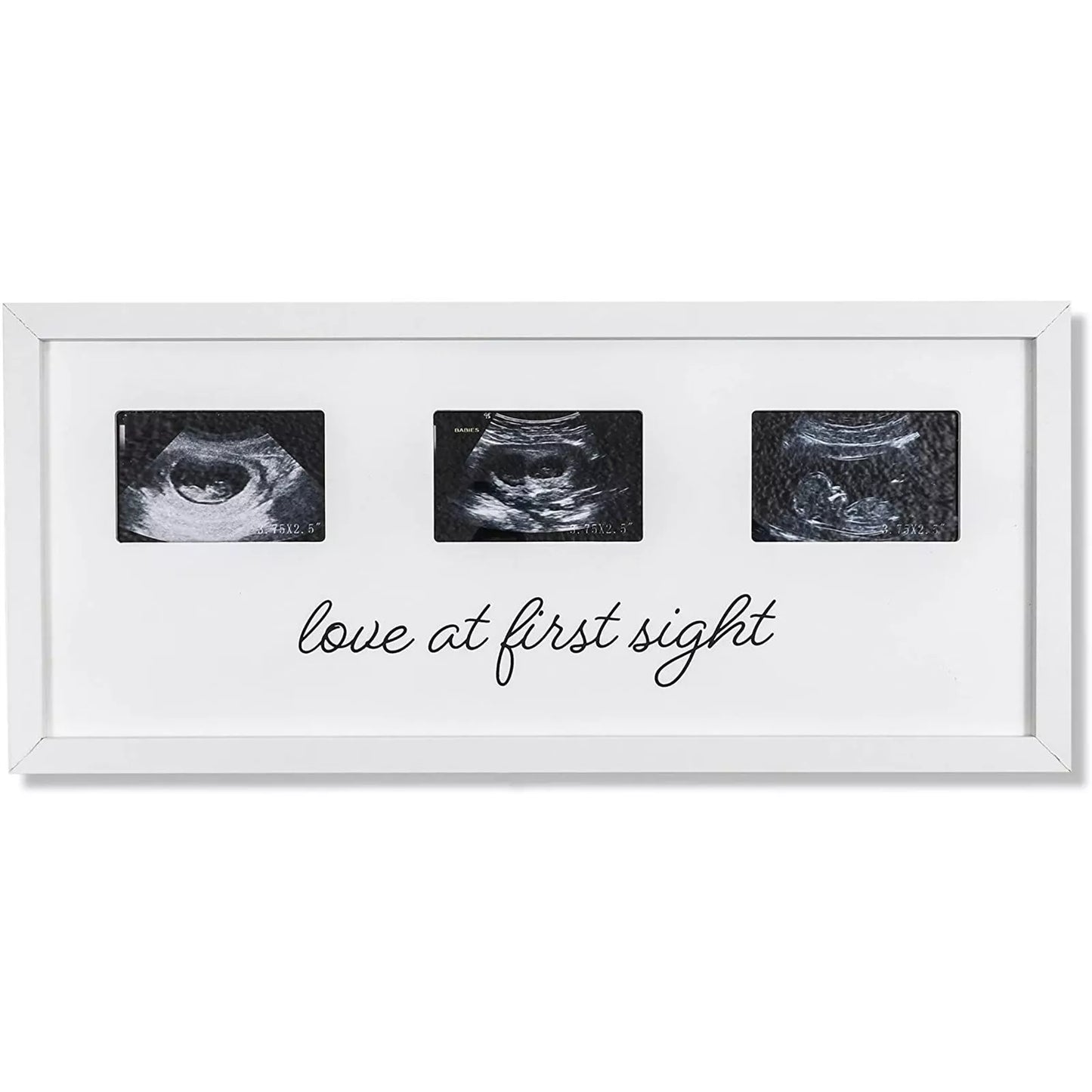 Sonogram Picture Frame for 3 Ultrasound Keepsake Photos