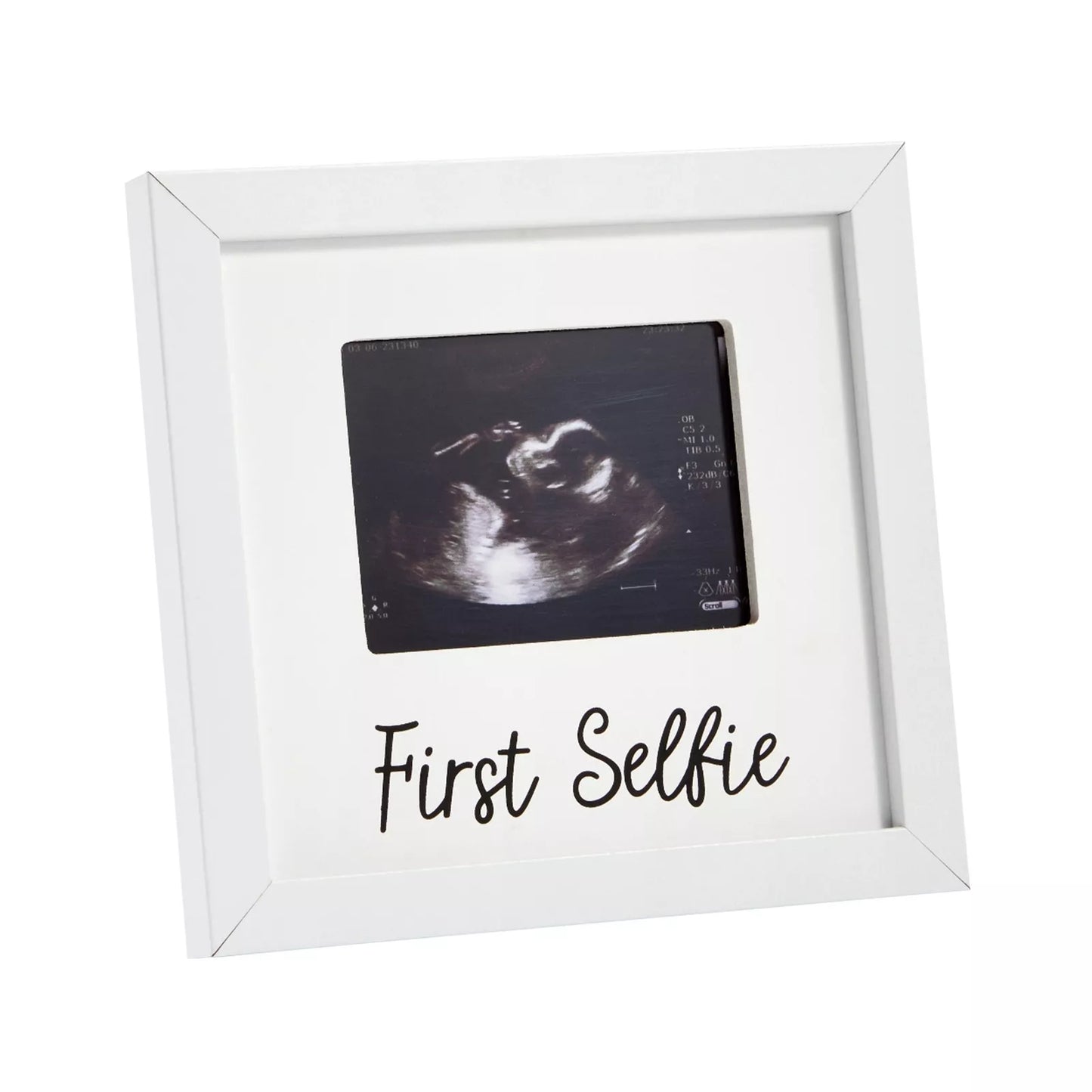 7x6.5 Inch Ultrasound Photo Frame for Baby Sonogram