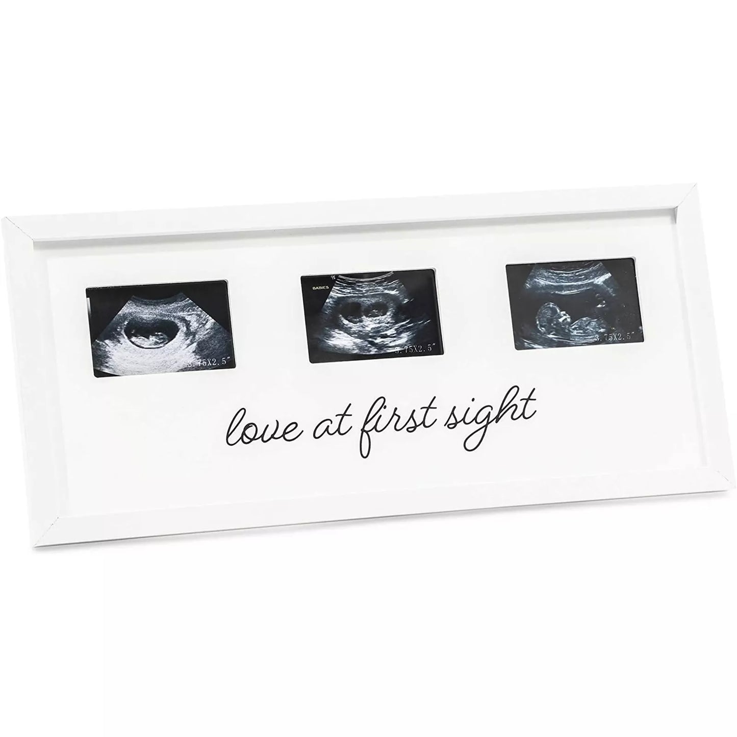 Sonogram Picture Frame for 3 Ultrasound Keepsake Photos